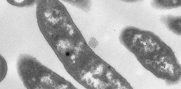 2025.12.15 Cold_Life_ _TEM image of P arcticus grown in NaCl 5.jpg