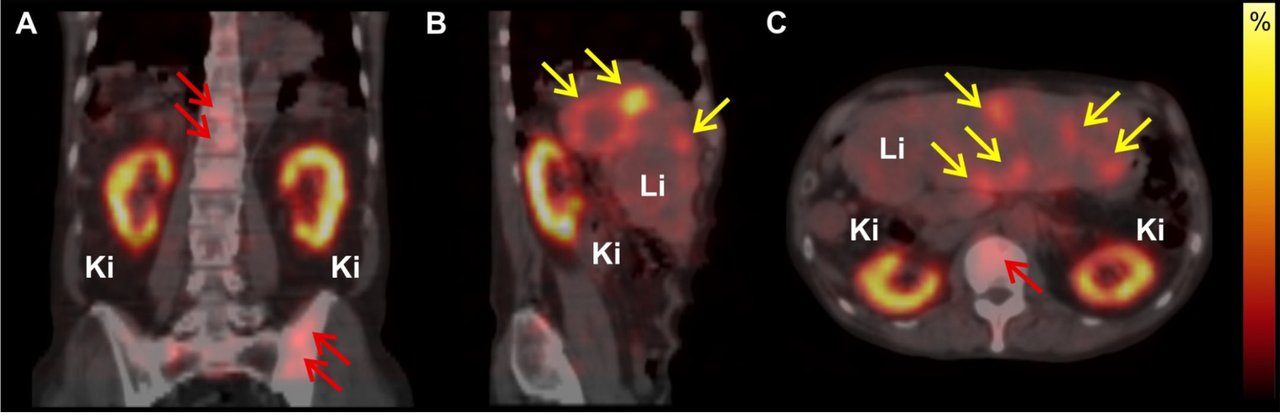 220316 Muller Fig1.jpg