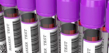 Blood biomarkers AdobeStock_293210446.jpeg