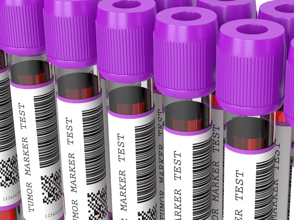 Blood biomarkers AdobeStock_293210446.jpeg