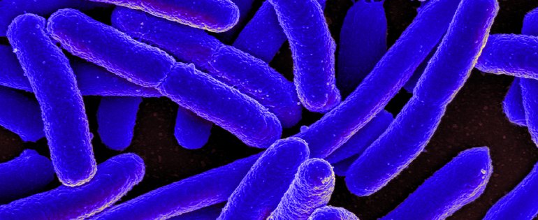 E._coli_Bacteria.jpg