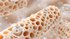 Peeking into pores